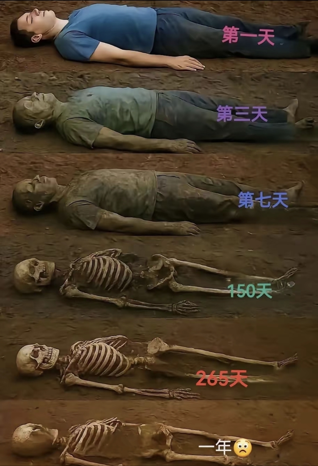 埃博拉病毒僵尸怎么回事,埃博拉病毒患者变丧尸-第1张图片